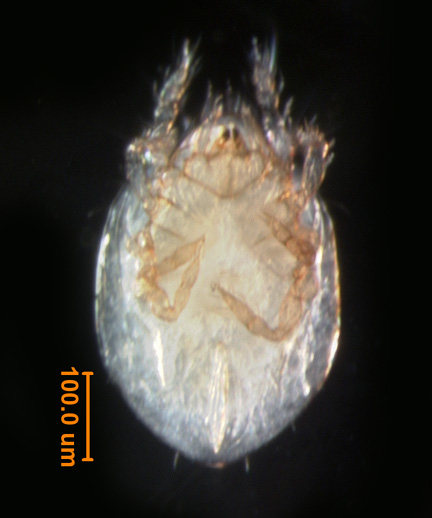 Photo of 11B (ventral)