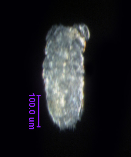 Photo of 18B (dorsal)