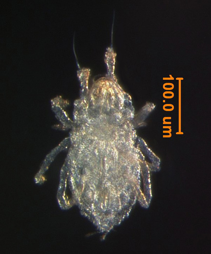 Photo of 1R (ventral)