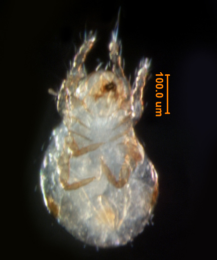 Photo of 2D (ventral)