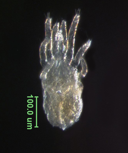 Photo of 3X (ventral)