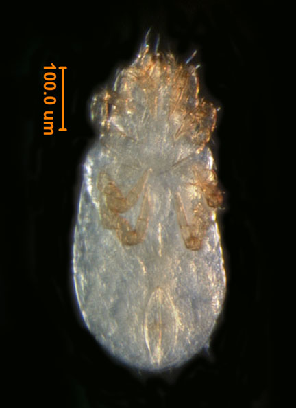 Photo of A3 (ventral)