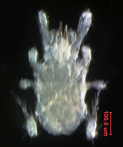 Photo of AB2 (ventral)