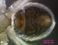 Photo of AK5 (epigynum and spinneret detail)