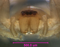 Photo of AU2 (eye detail)