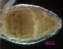 Photo of AY3 (ventral abdomen detail)