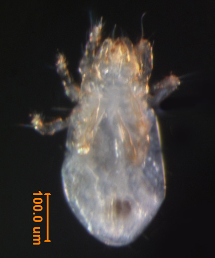 Photo of BR (ventral)