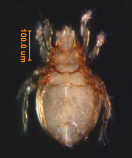 Photo of F4 (ventral)