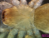 Photo of R4 (dorsal cephalothorax detail)
