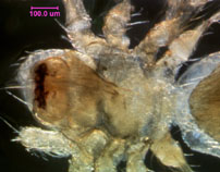 Photo of R6 (dorsal cephalothorax detail)