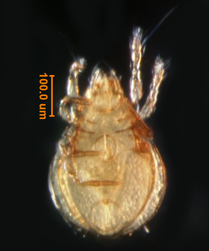 Photo of W2 (ventral)
