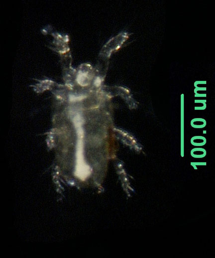 Photo of ZM6 (dorsal)